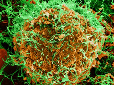 Ilustrasi Virus Ebola/Foto: Wikipedia