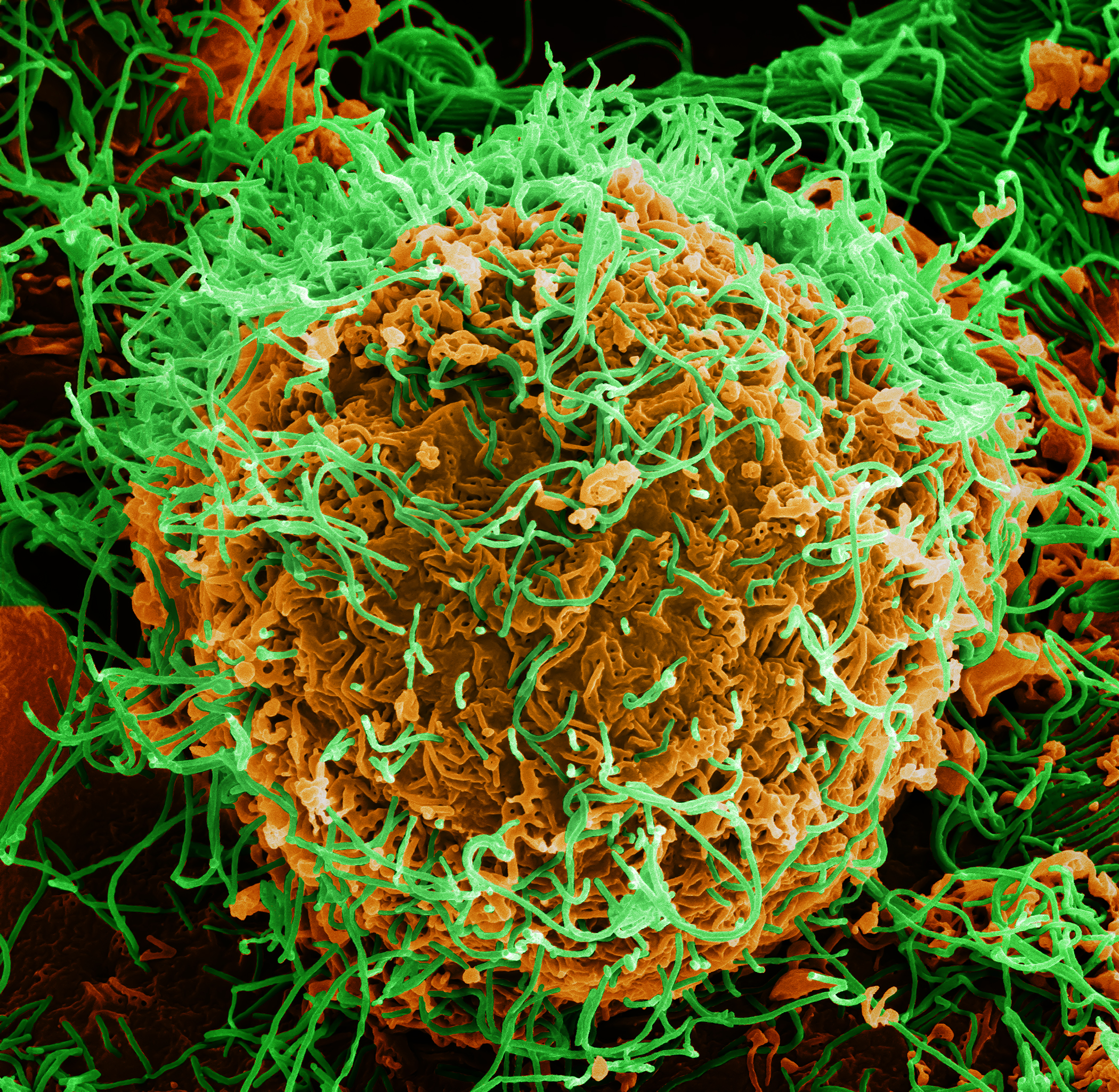 Ilustrasi Virus Ebola/Foto: Wikipedia